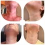 ‘Gua Sha’ Lymph Massage