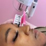 Dermaplaning facial treatment