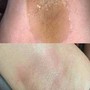 Underarm Wax