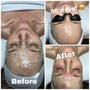 ADD-ON ONLY! Dermaplaning