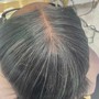 Scalp Treatment