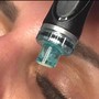 FRESH BEAUTY HydraFacial