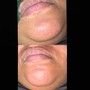 Lip and Chin Wax