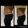 60 Min Body Contour(Non-invasive Lipo)