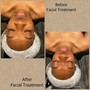 Royal Facial Back (Deep Tissue Treatment)