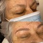 Beard Fill-In Microblading 