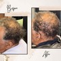 Senior Alopecia Steam+Root Stimulation Massage