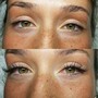 Eyelash Extension Removal