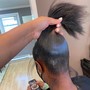 Scalp Treatment