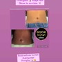 60 Min Body Contour(Non-invasive Lipo)