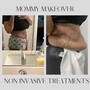 Mommy Makeover Treatment (sidesn &amp;back)