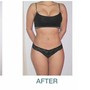 Lipo laser fat loss