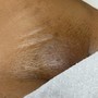 Brazilian and Underarm Wax