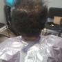 Scalp Treatment