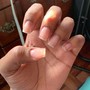 Nail Repair