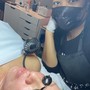 Oxygen Facial