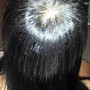 Scalp Treatment