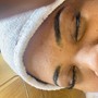 Scalp Treatment