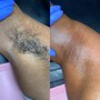 Underarm Wax