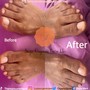 Pedicure - Soak-Off / Removal