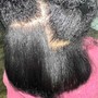 Dandruff Scalp Treatment