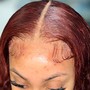 Scalp Treatment