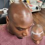 Scalp Micropigmentation