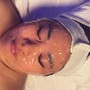 Forehead Wax