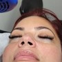 Oxygen Facial