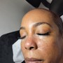 Oxygen Facial