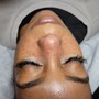 Oxygen Facial