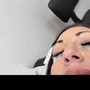 Pre-Teen Facial