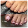 Toenail reconstruction/ pedicure/ no acrylic