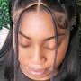 Scalp Treatment