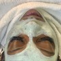 Acne Facial