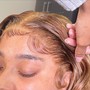 Scalp Treatment