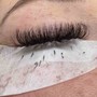 Microdermabrasion