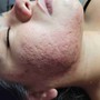 Organic Back Facial