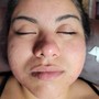 Organic Back Facial