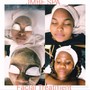 Acne Facial