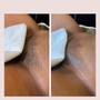 Brazilian Wax