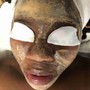 Acne Facial