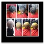 Scalp Treatment