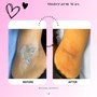 Brazilian wax+ Post wax Vajacial