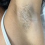 Basic Underarm facial