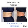 30 min Fat Cavitation on one area