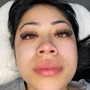 Eyelash Extension Removal