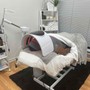 Microdermabrasion