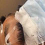 Eyelash Extension Removal