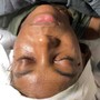 "BACK FACIAL " Treatment